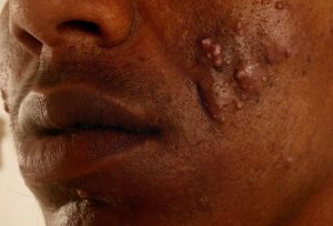 Read more about the article If you rub a freshly cut tomato on your face for 3 seconds, here’s the effect