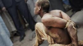 Read more about the article Africa Eye: Torture ‘rampant’ among Nigeria’s security forces